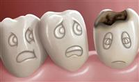 Diş çürüğü nasıl oluşur?